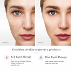 Katalyst F3 Photon LED Beauty Wand — Red + Blue Light, Ultrasonic
