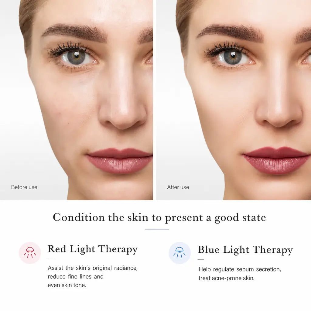 Katalyst F3 Photon LED Beauty Wand — Red + Blue Light, Ultrasonic