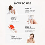 Katalyst F3 Photon LED Beauty Wand — Red + Blue Light, Ultrasonic
