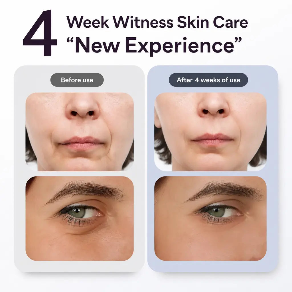 KATALYST M2 Pro 6-in-1 Multi-Functional RF Facial Device