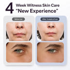 KATALYST M2 Pro 6-in-1 Multi-Functional RF Facial Device