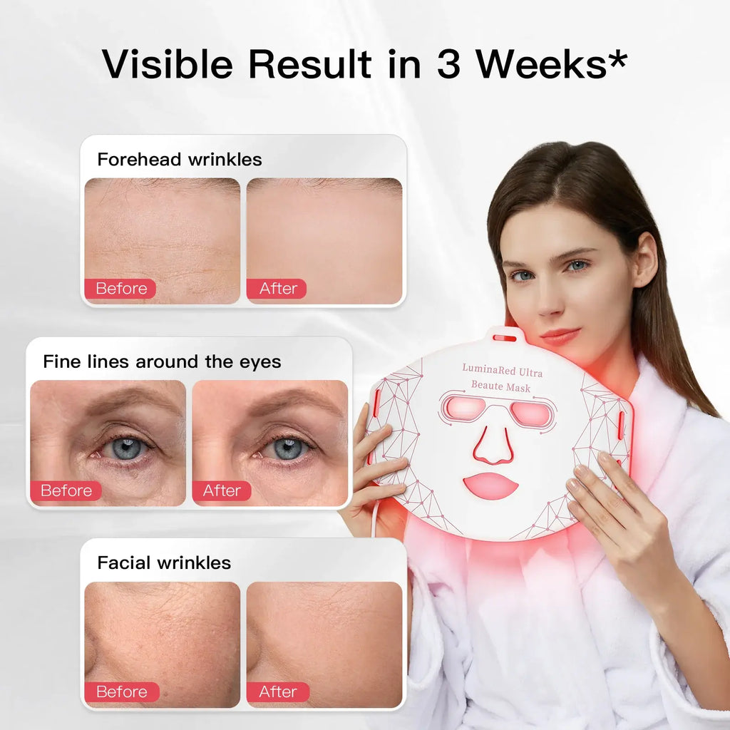 Katalyst LuminaRed Ultra LED Mask - 4-Wavelength Light Therapy Device with 288 Beams for Anti-Aging, Wrinkle Reduction & Skin Rejuvenation